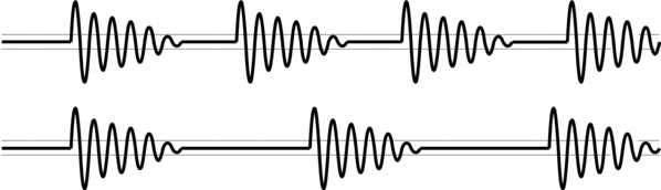 Achieve the desired tissue effect by selecting the appropriate electrosurgical mode on the VIO® 3, such as endoCUT®, preciseSECT®, softCOAG, or dryCOAG, tailored to the interventional technique.